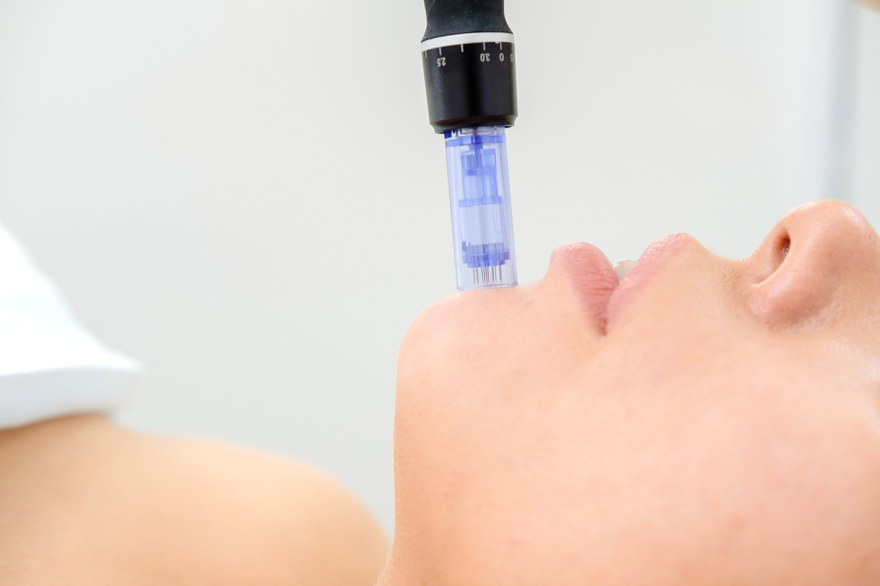 Cosmetologist making mesotherapy injection. Microneedle mesotherapy. Treatment woman at beautician. Hardware cosmetology. Mesotherapy, dermapen, treatment of face zone, face rejuvenation.  Close up HALO AESTHETICS BAR - West Hollywood’s Best-Kept Beauty Secret